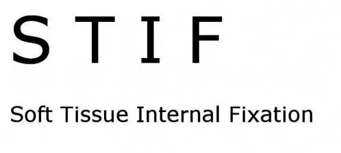 STIF SOFT TISSUE INTERNAL FIXATION