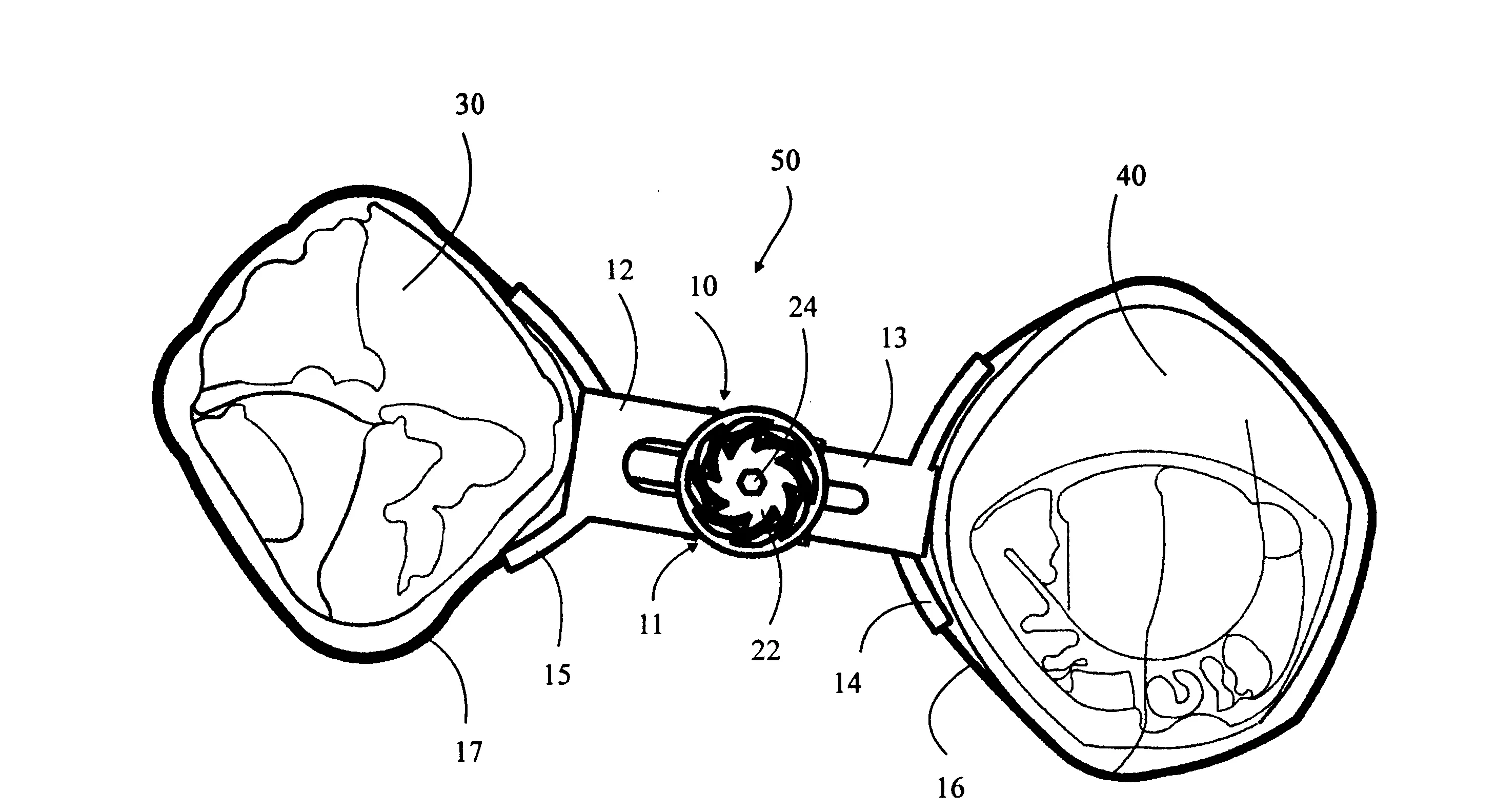 Dispositif dentaire pour combler temporairement l'edentement consecutif a l'extraction d'une dent et procede de mise en oeuvre de ce dispositif