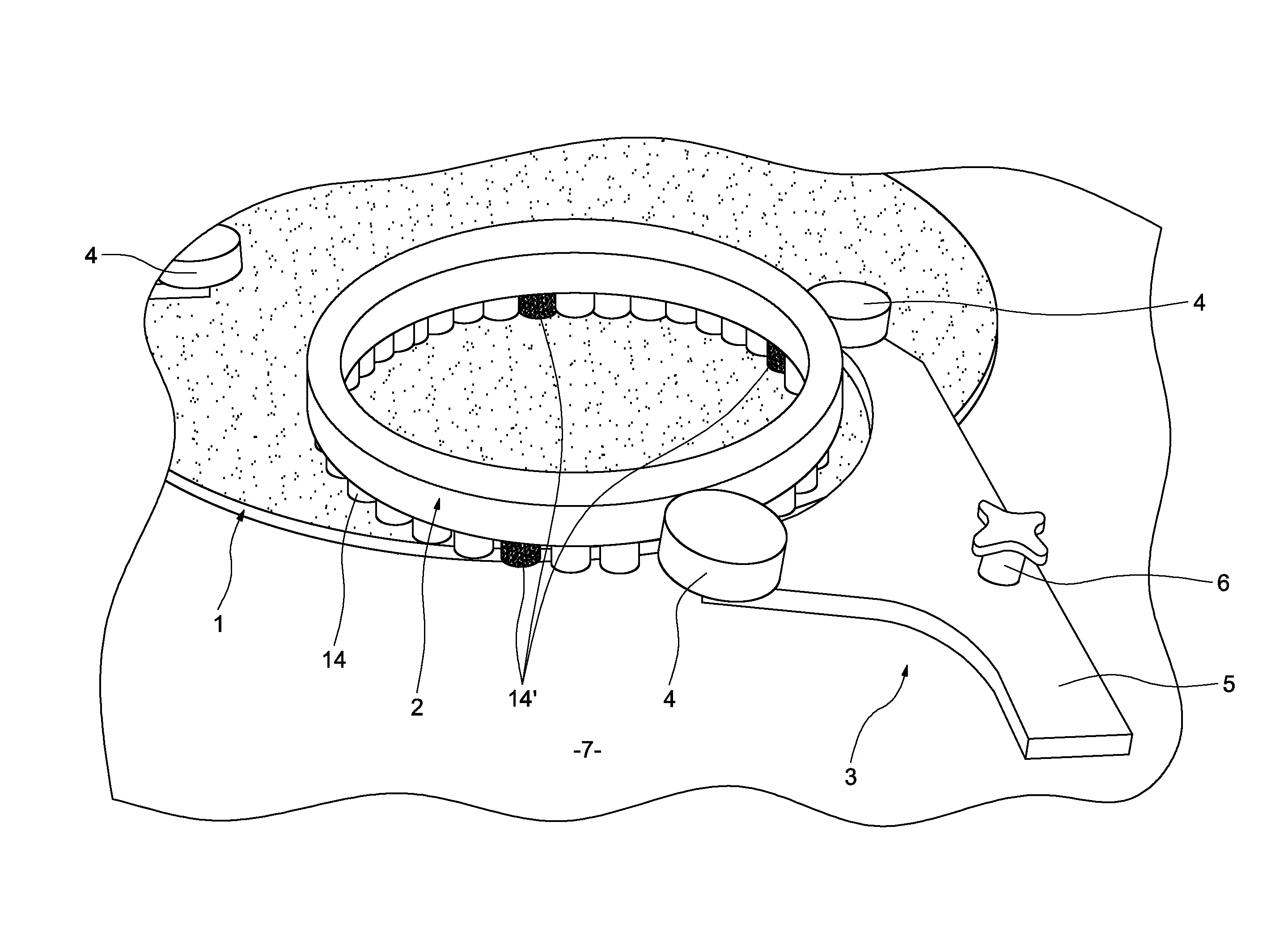 Systeme de traitement de surface, par effet d'abrasion, de pieces mecaniques, notamment de rodage