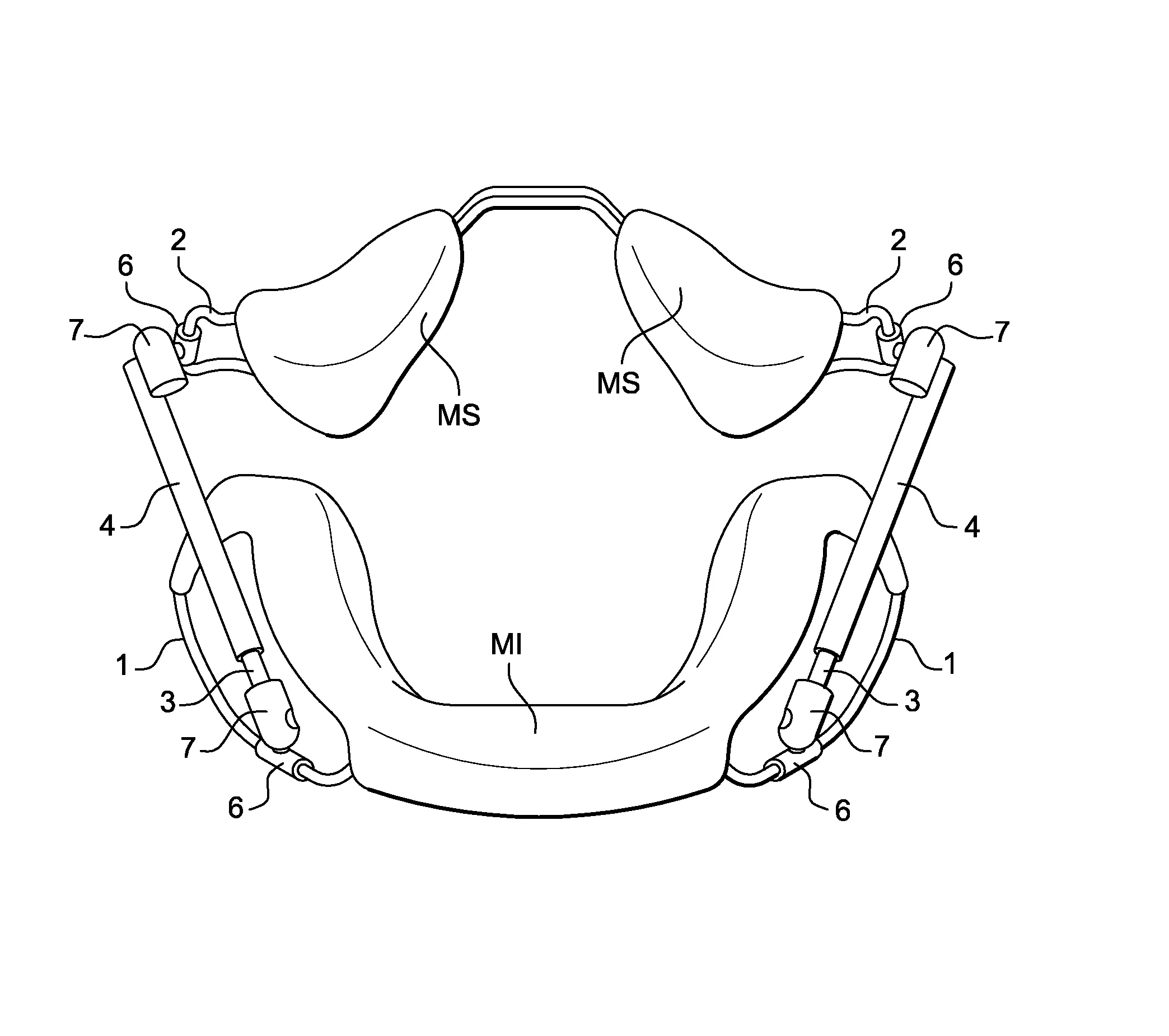 Dispositif d'articulation d'un ensemble orthodontique apte a provoquer un deplacement d'une mandibule par rapport a un maxillaire