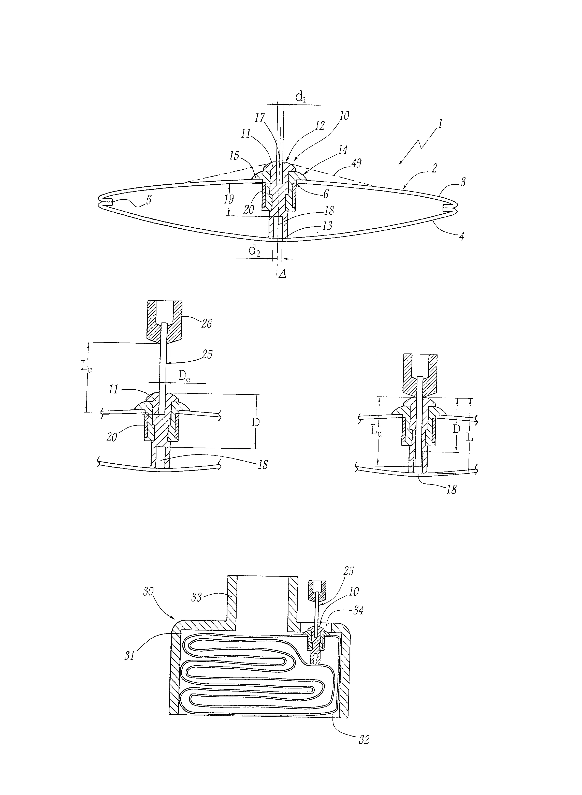 Ballon intra-gastrique.