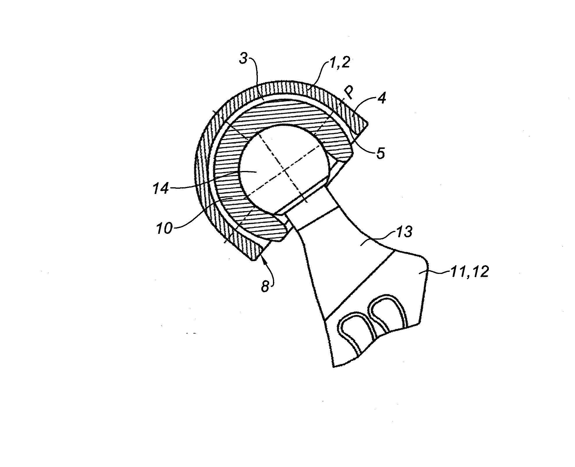 Cupule metallique pour implant cotyloidien