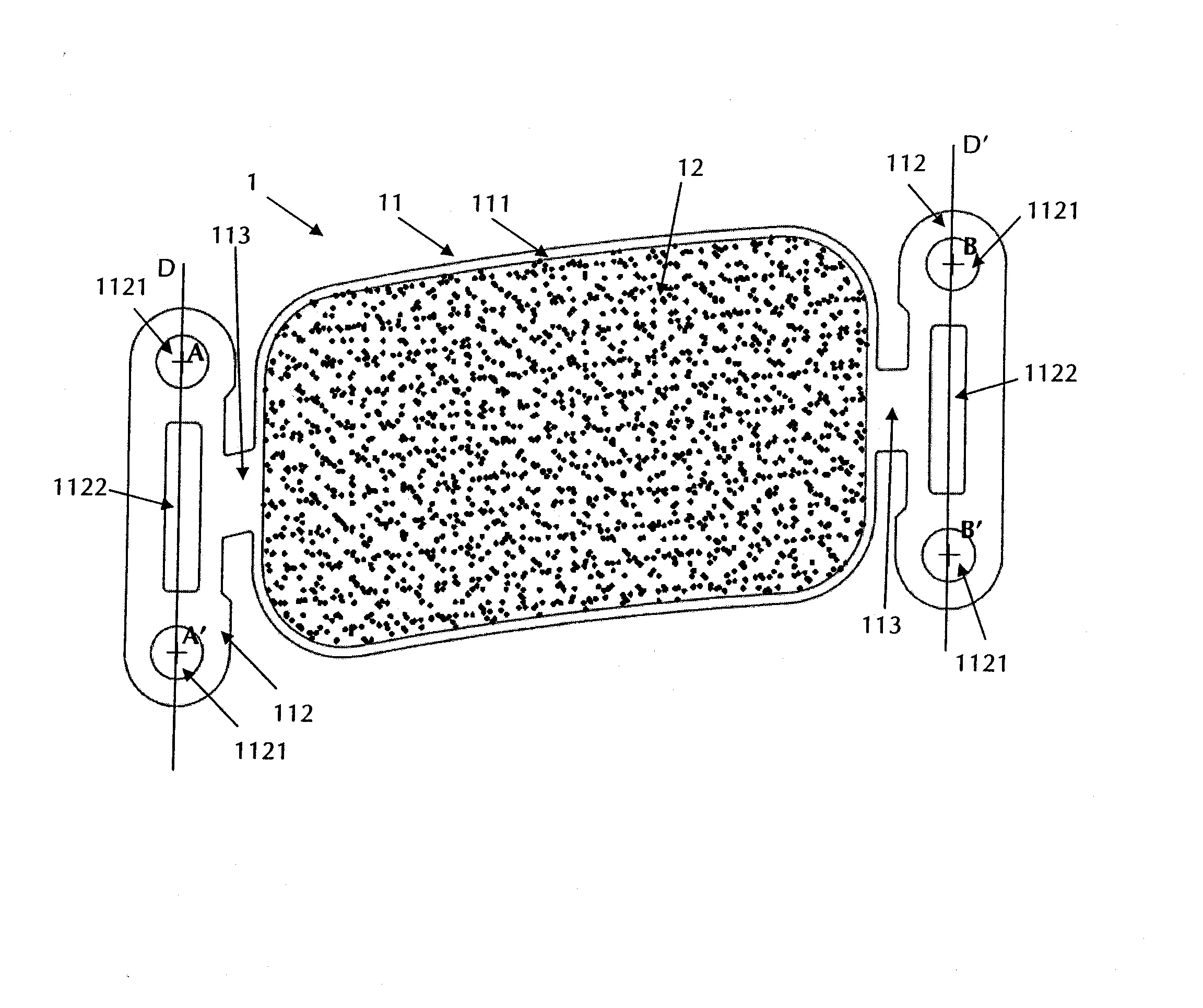 Plot de friction souple et garniture de frein pourvue d'un tel plot