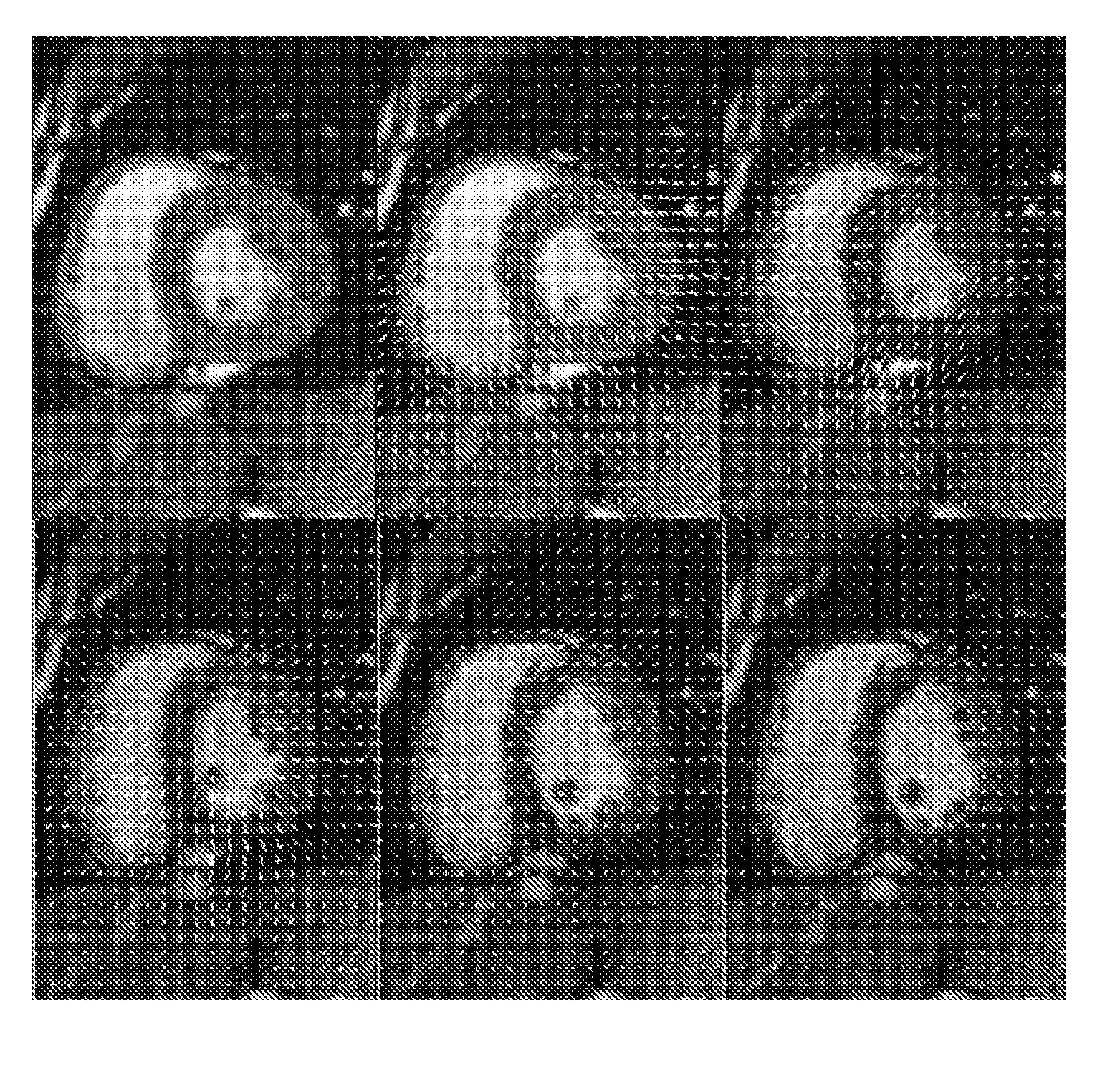 Procede d'estimation du mouvement dans une sequence d'images dynamiques