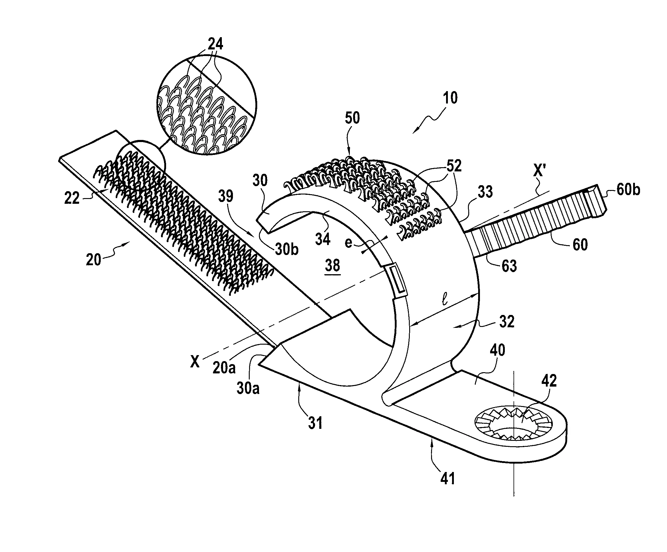 Collier d'attache pour des elements allonges