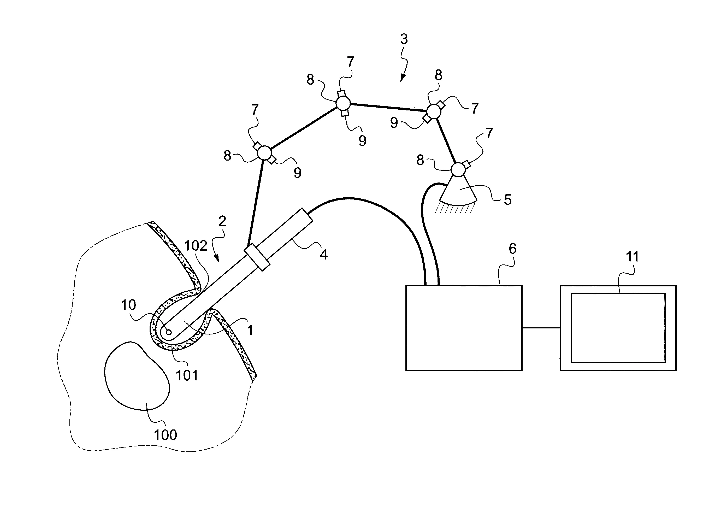 Dispositif de guidage d'un instrument medical insere dans une voie naturelle ou une voie artificielle d'un patient