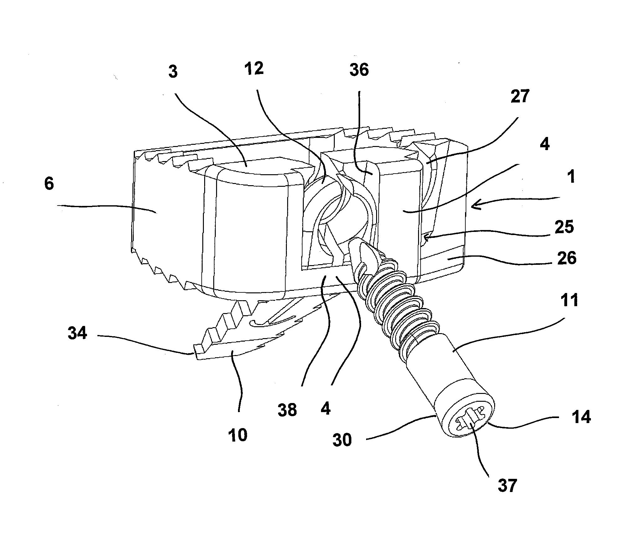 Implant rachidien intervertebral