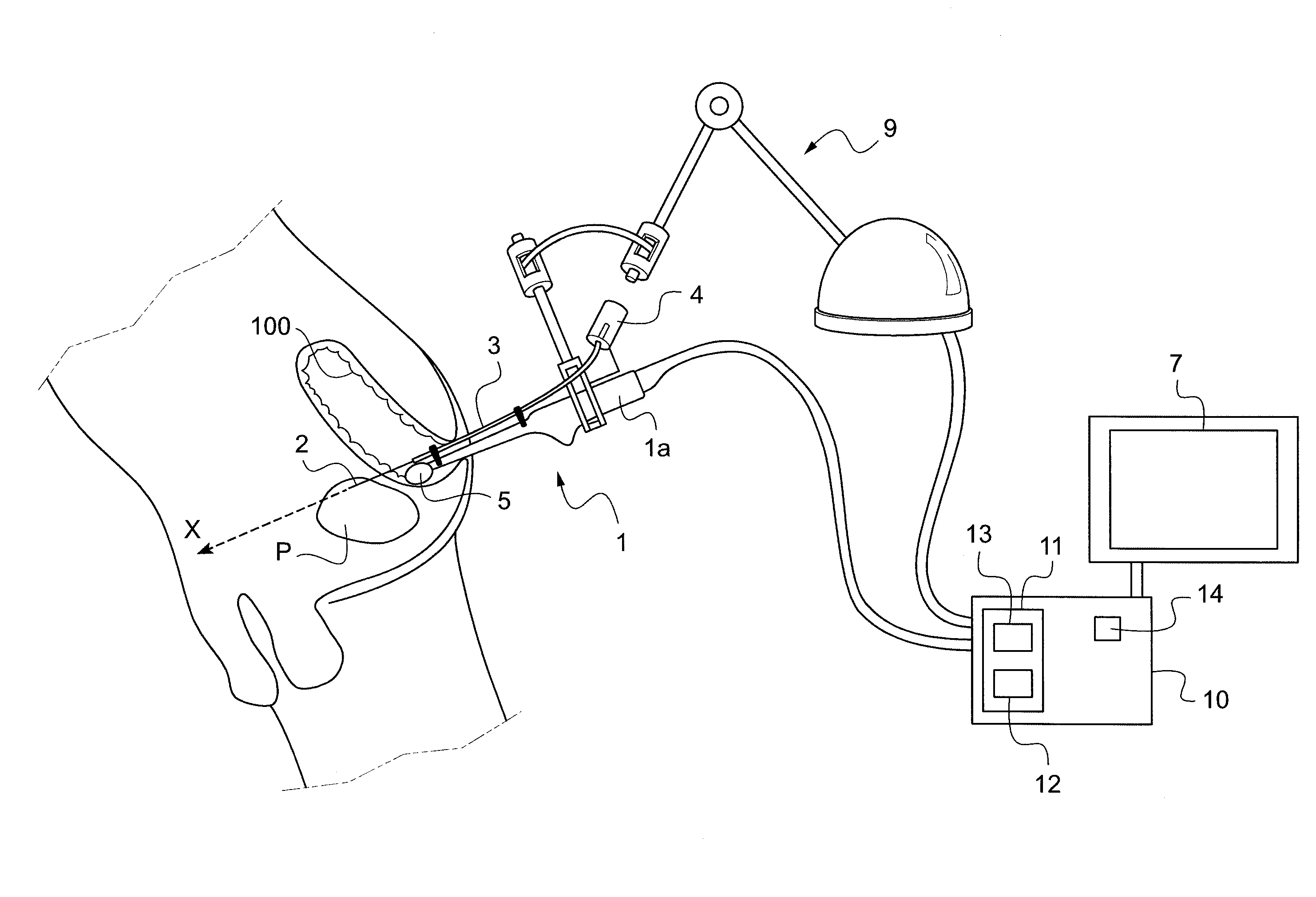 Dispositif d'assistance au positionnement d'un instrument medical relativement a un organe interne  d'un patient et procede de commande d'un tel dispositif