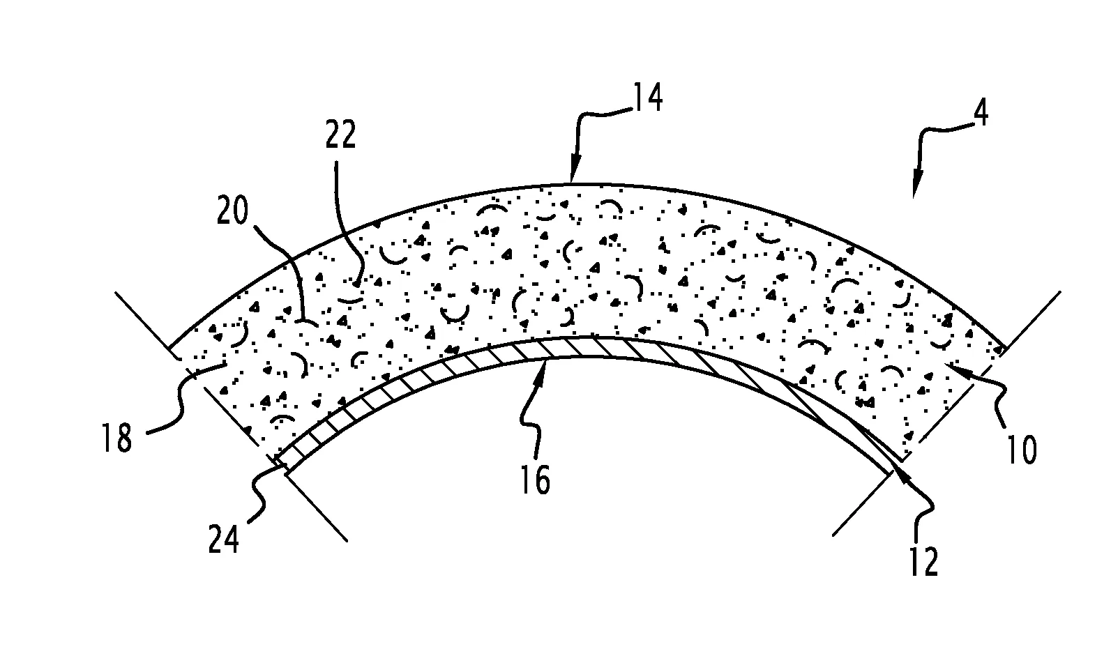 Element tubulaire et procede correspondant