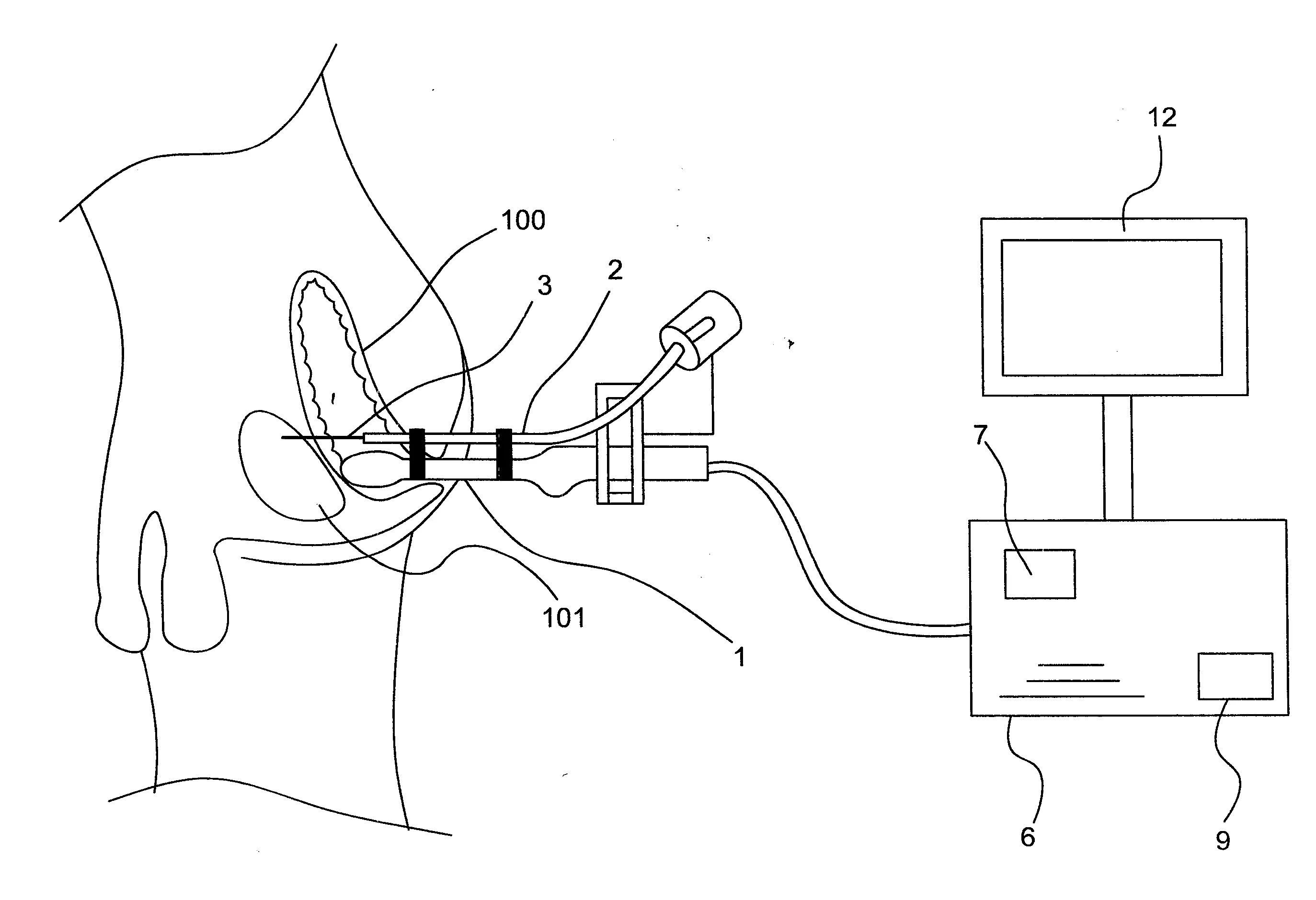 Dispositif de guidage d’une sonde d’imagerie medicale, sonde d’imagerie medicale adaptee a etre guidee par un tel dispositif et procede de guidage d’une telle sonde.