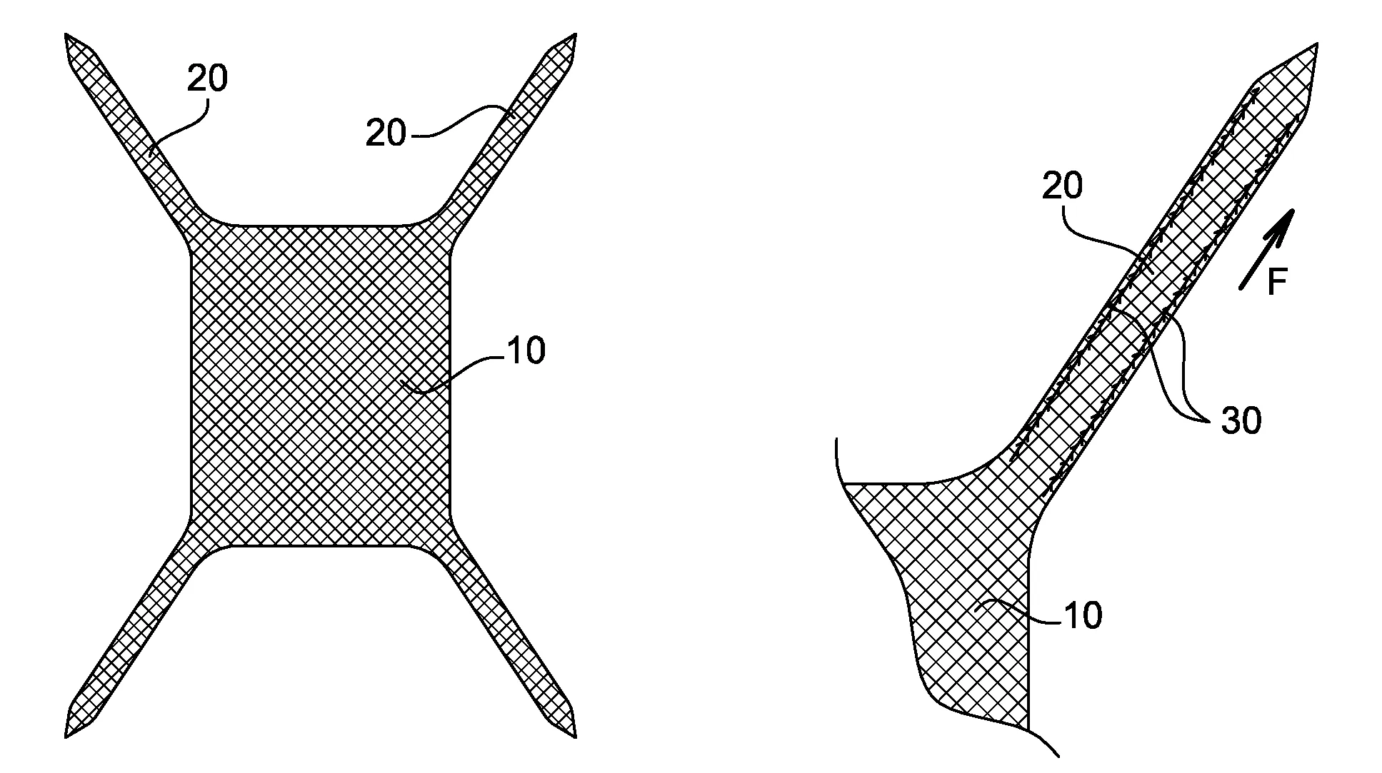 Prothese implantable de renfort, en particulier pour le renfort de la paroi abdominale