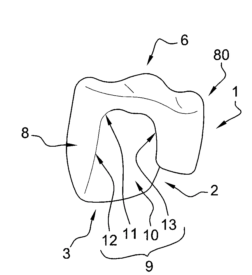 Dent artificielle adaptee a la realisation d'une armature de prothese dentaire sur implant et procede de realisation d'une telle armature