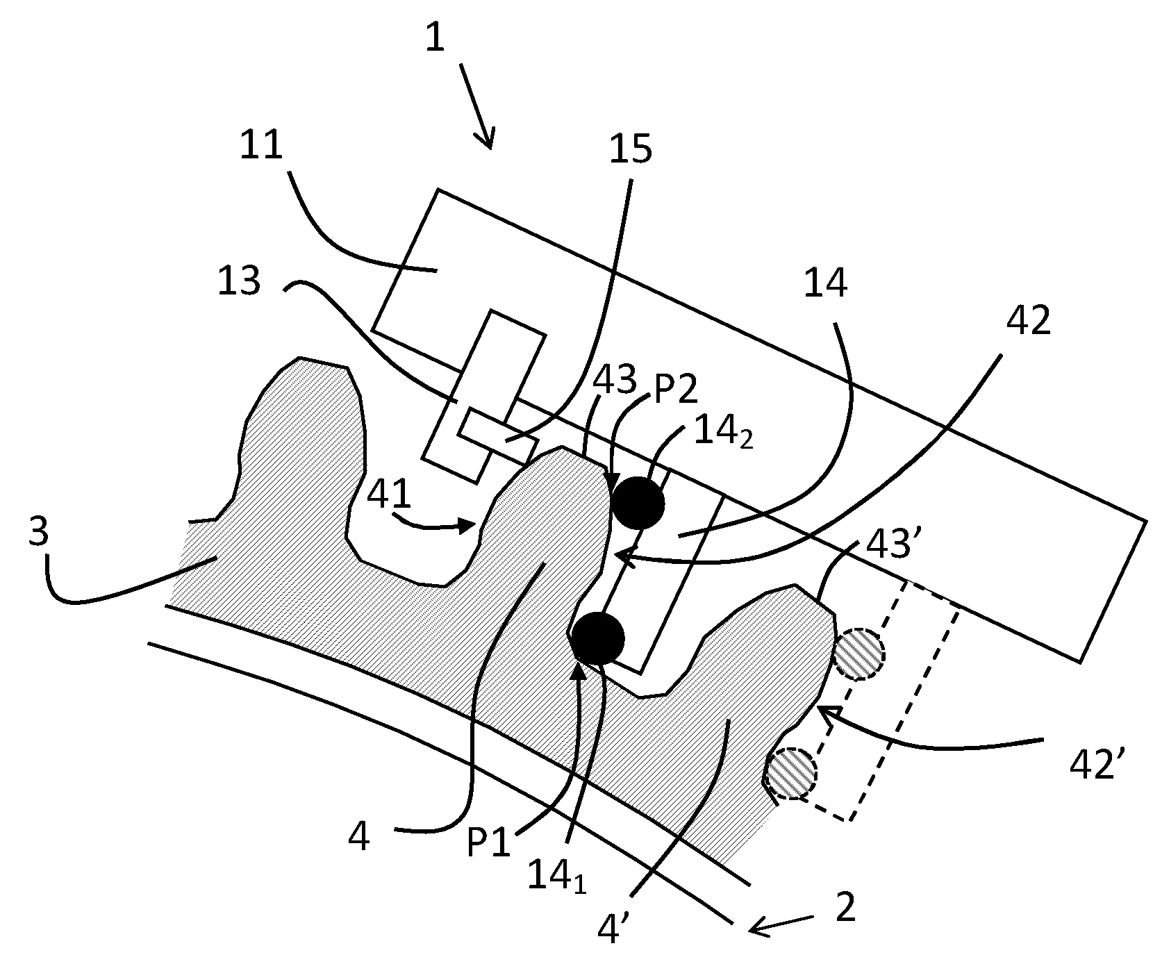 Procede de reparation de la denture d'une couronne