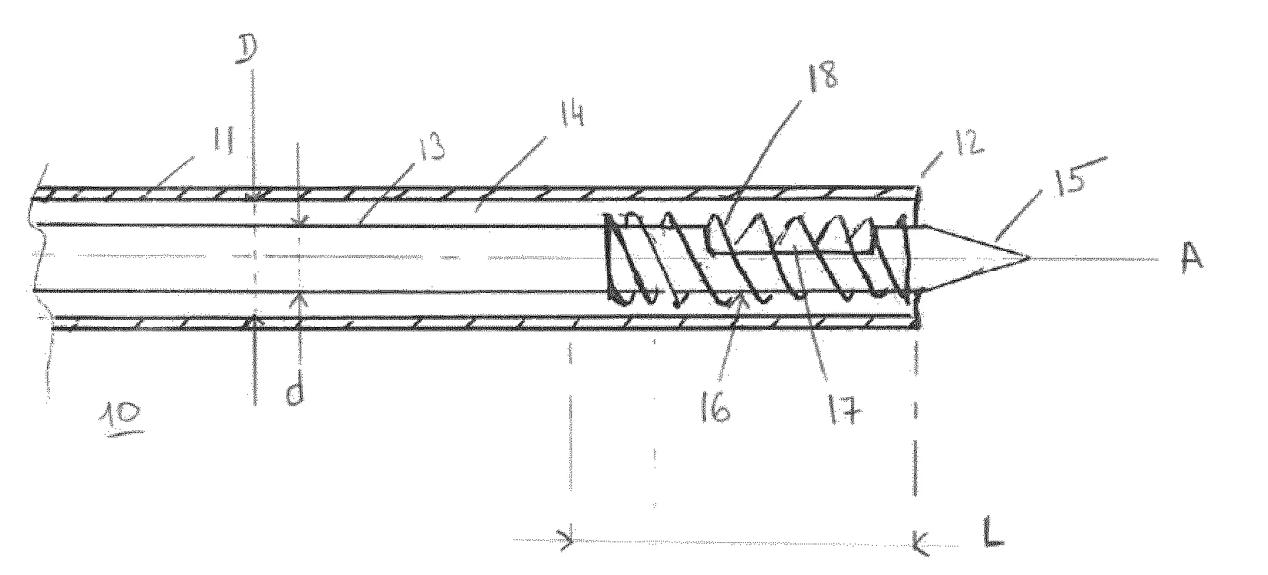 Systeme d'injection dirigee intra-osseuse de ciment chirurgical