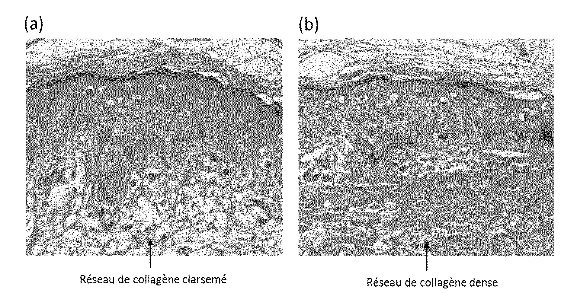 Extraits de faine de hetre, compositions et utilisations