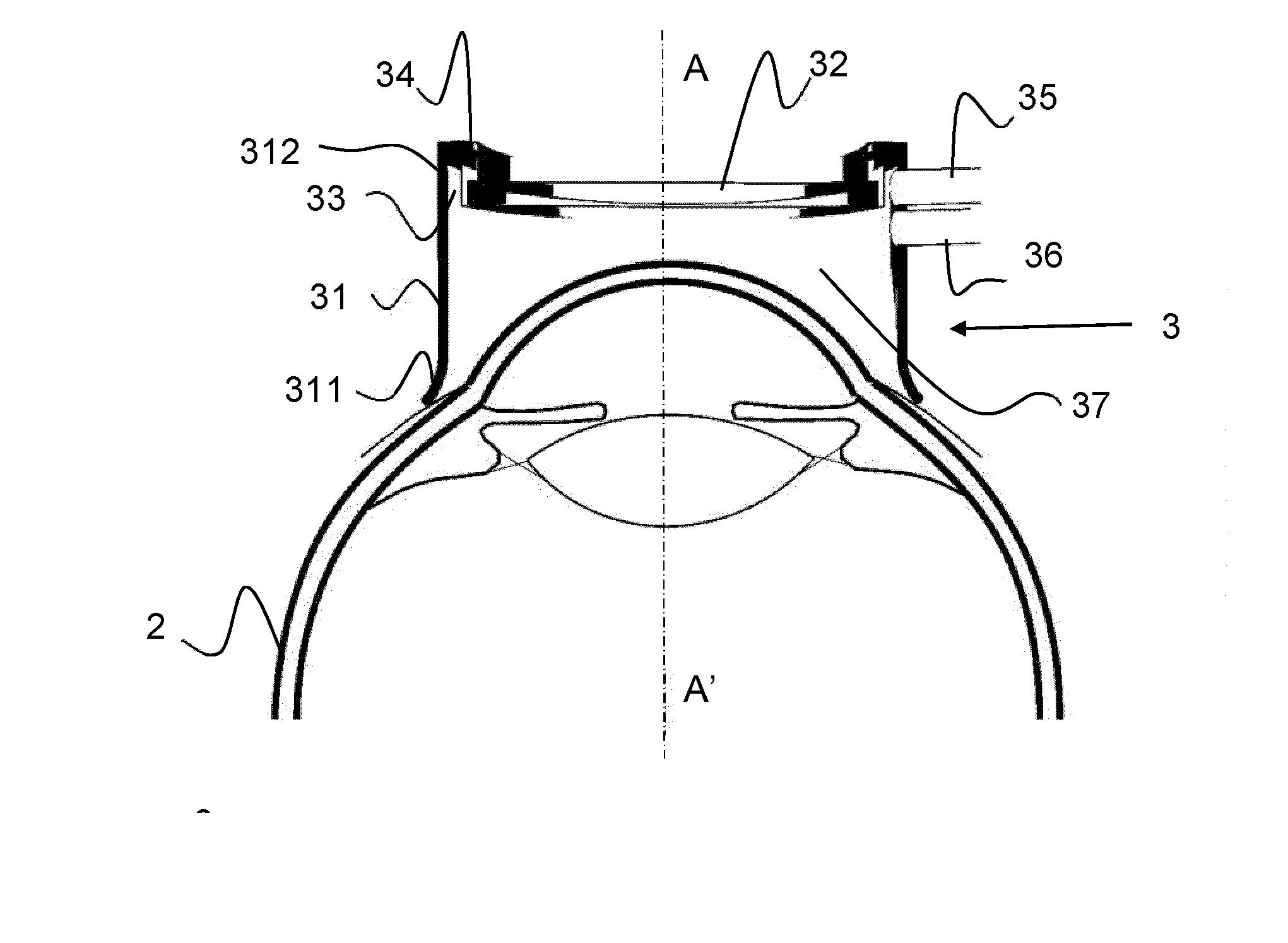 Interface de couplage entre une source laser et un tissu a traiter